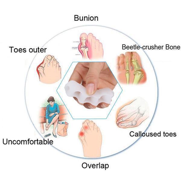 Orthopedic Toe Bunion Corrector 2.0 - Toe Separator